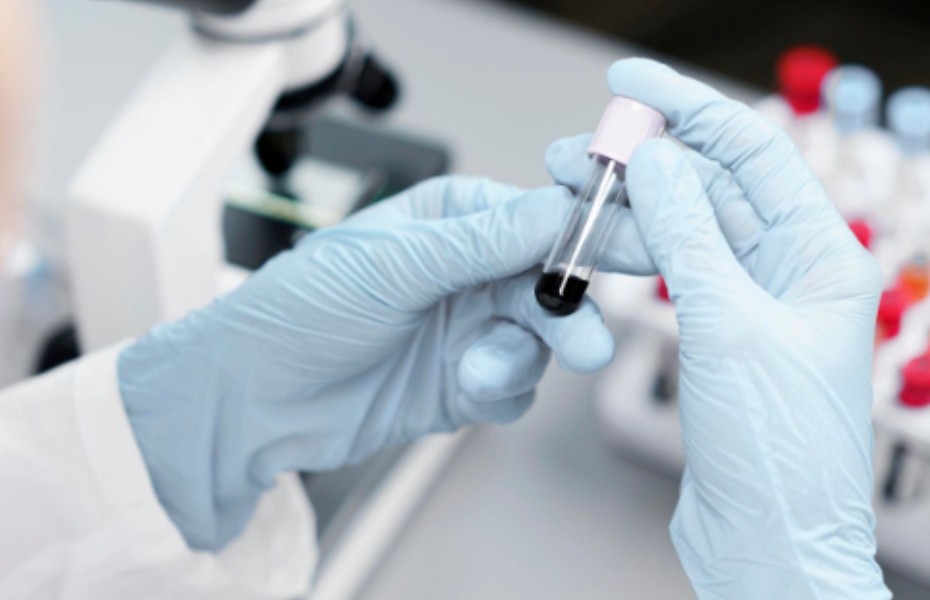 LIJEČENJE HIV-A 

UZ POMOĆ MATIČNIH ĆELIJA